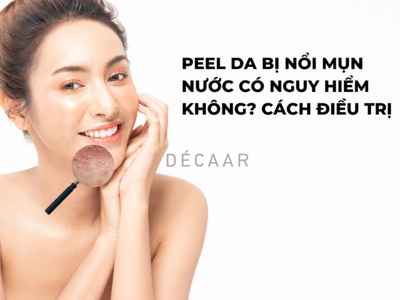 peel da bị nổi mụn nước